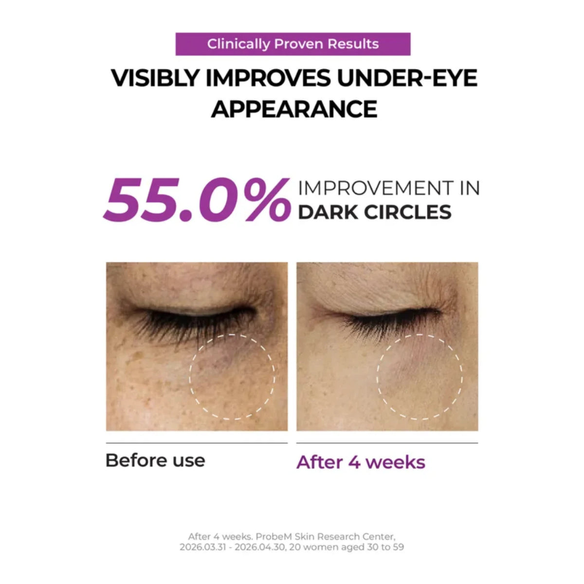 Niacinamide 5+ Dark Circle Correcting Eye Cream