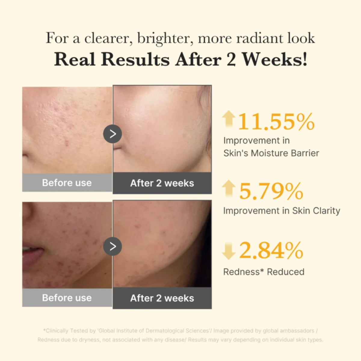 Kojic Acid Turmeric Niacinamide Serum