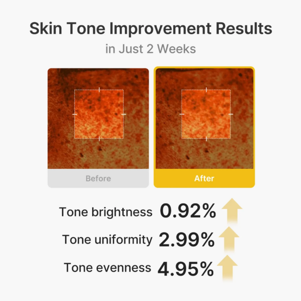 Kojic Acid Turmeric Vita Capsule Cream