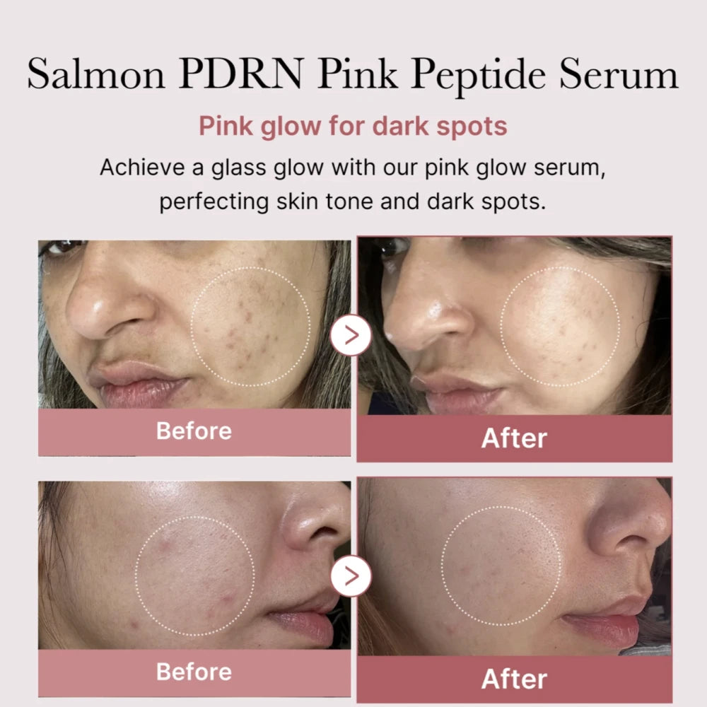 PDRN Pink Peptide Serum