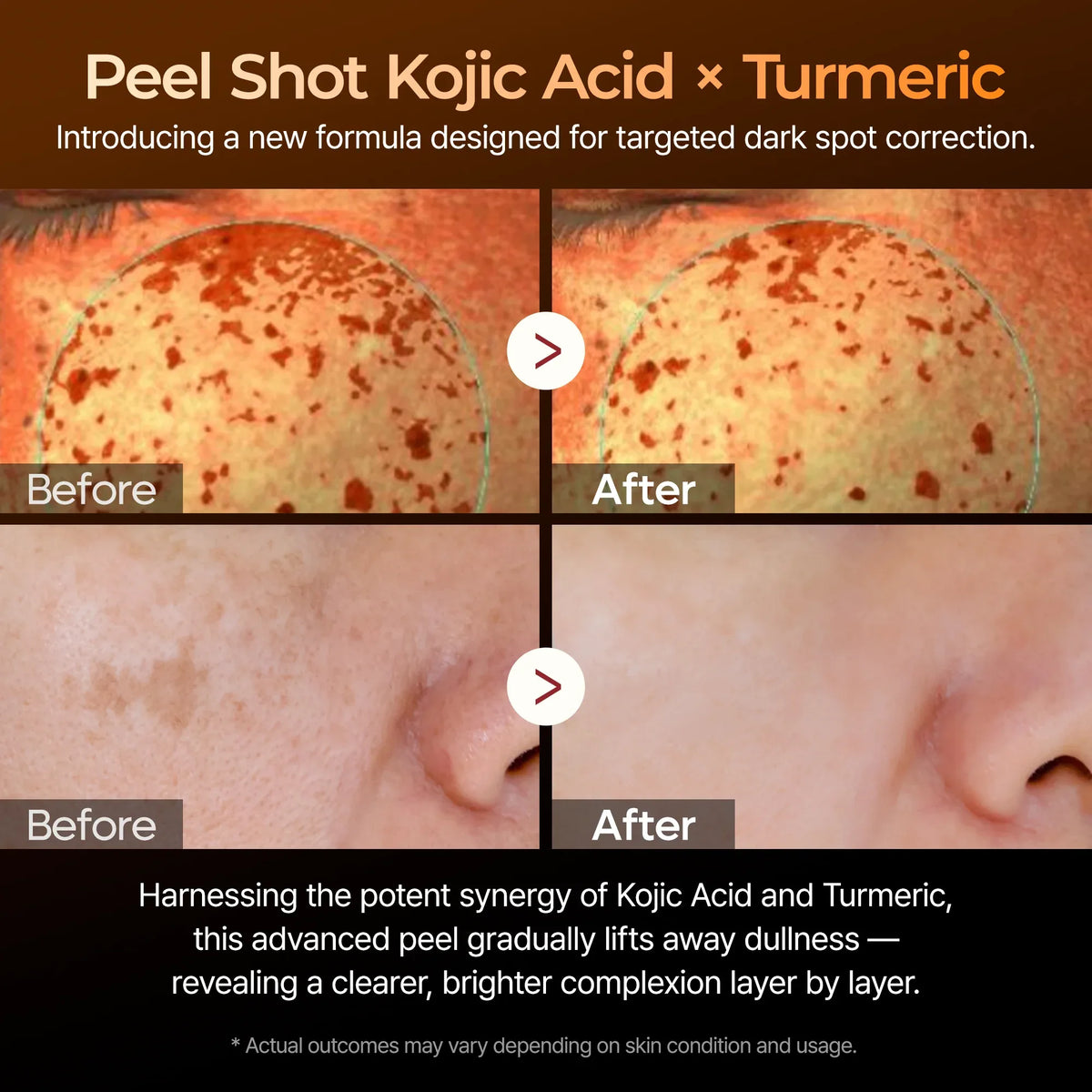 Peel Shot Exfoliating Kojic Acid Turmeric Serum