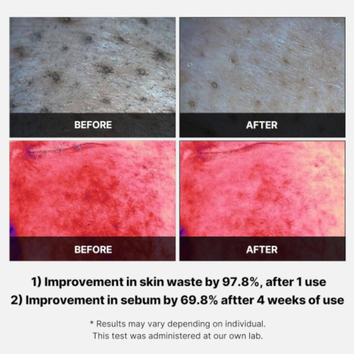 Red Succinic Peeling Pad
