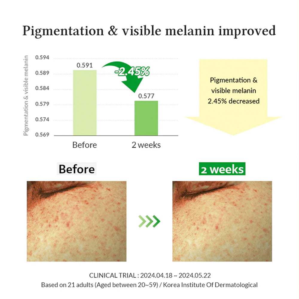 Gentle Vitamin C Serum