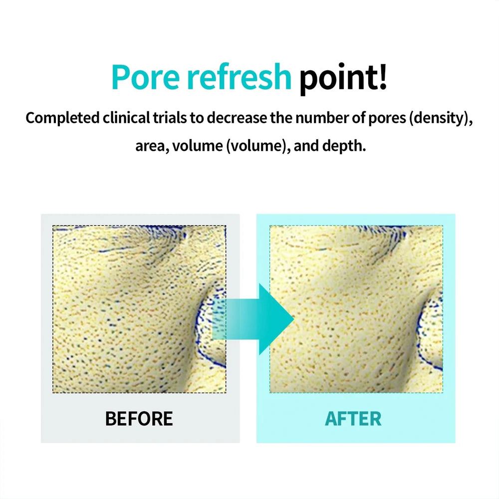 Moringa Tightening Pore Serum