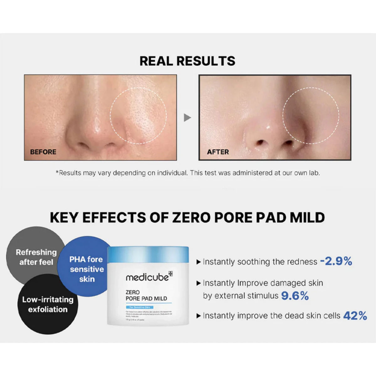 Zero Pore Pad Mild
