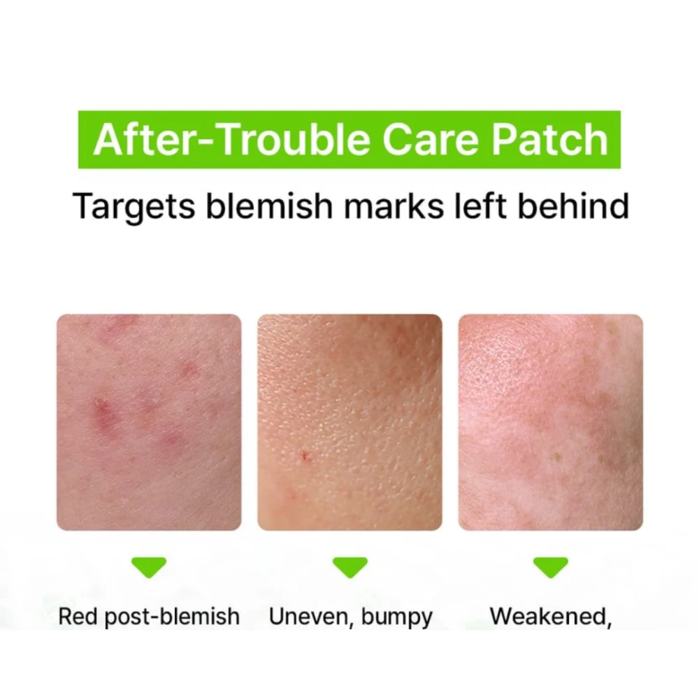 Blemish Care Microcone Patch