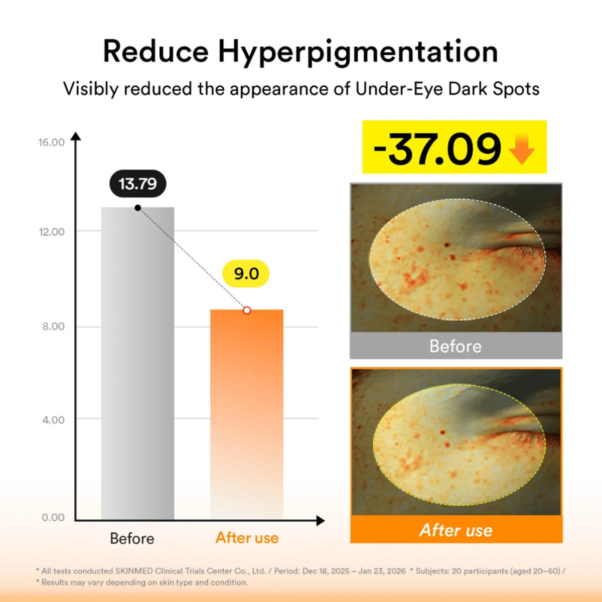 Glutathione Kojic Acid Eye Patch Vita Jelly