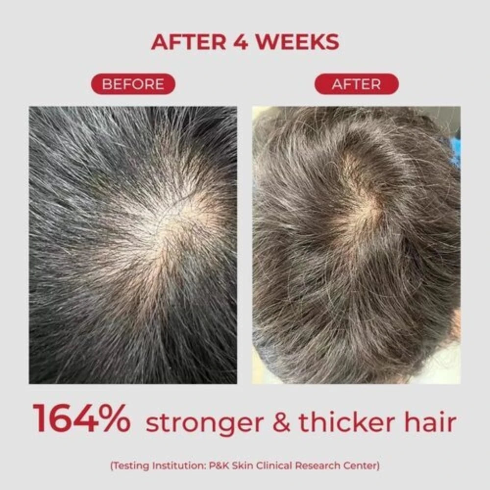 Annurcatin Shampoo