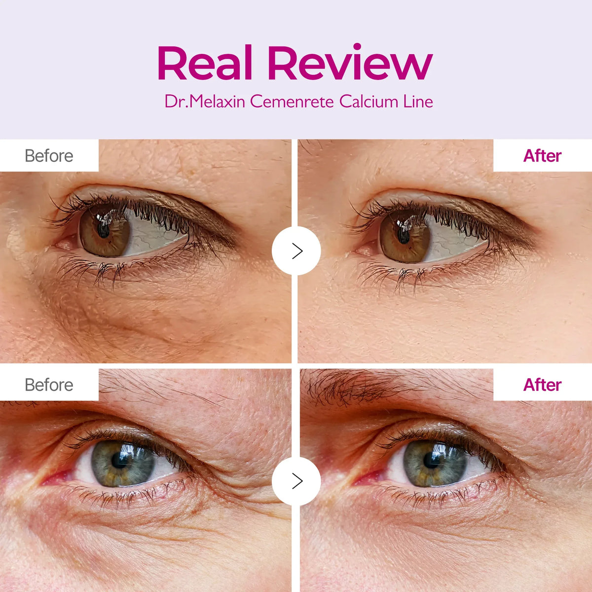 Cemenrete Calcium Volume Eye Patch