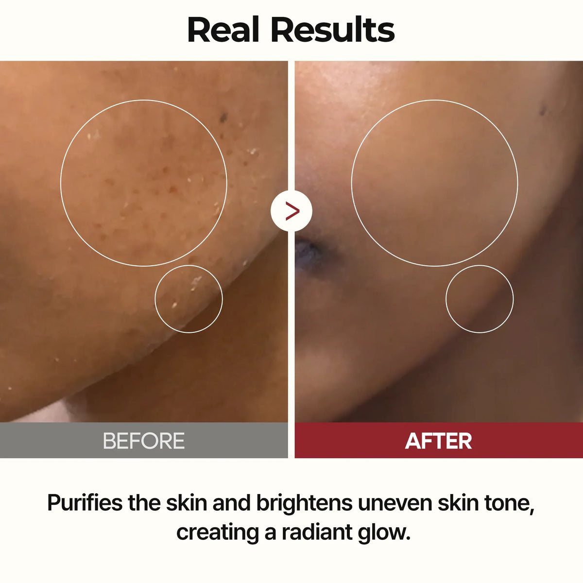 Peel Shot Glow White Rice Toner
