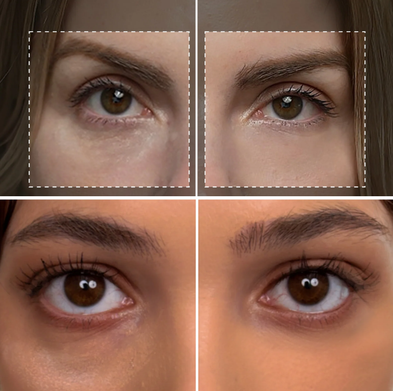 Eyephalt Retinol Eyebag Cream