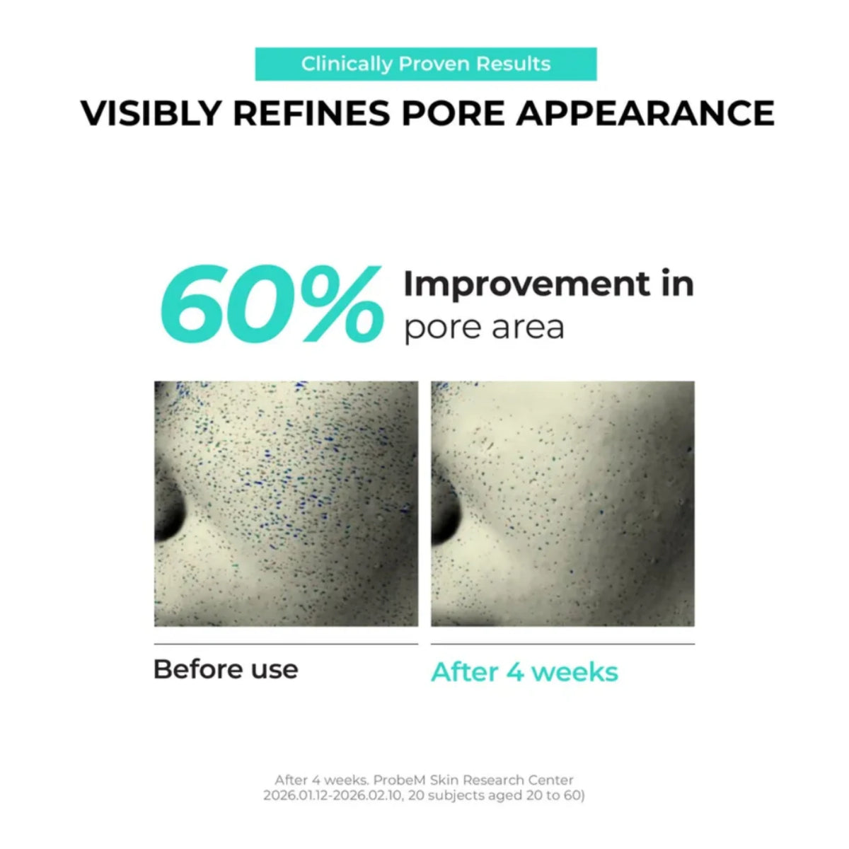 Overnight Zero Pore Nose Patch