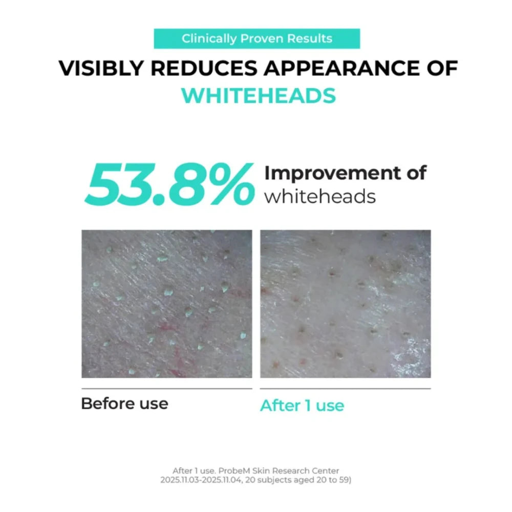 Pore Melting Peeling Gel