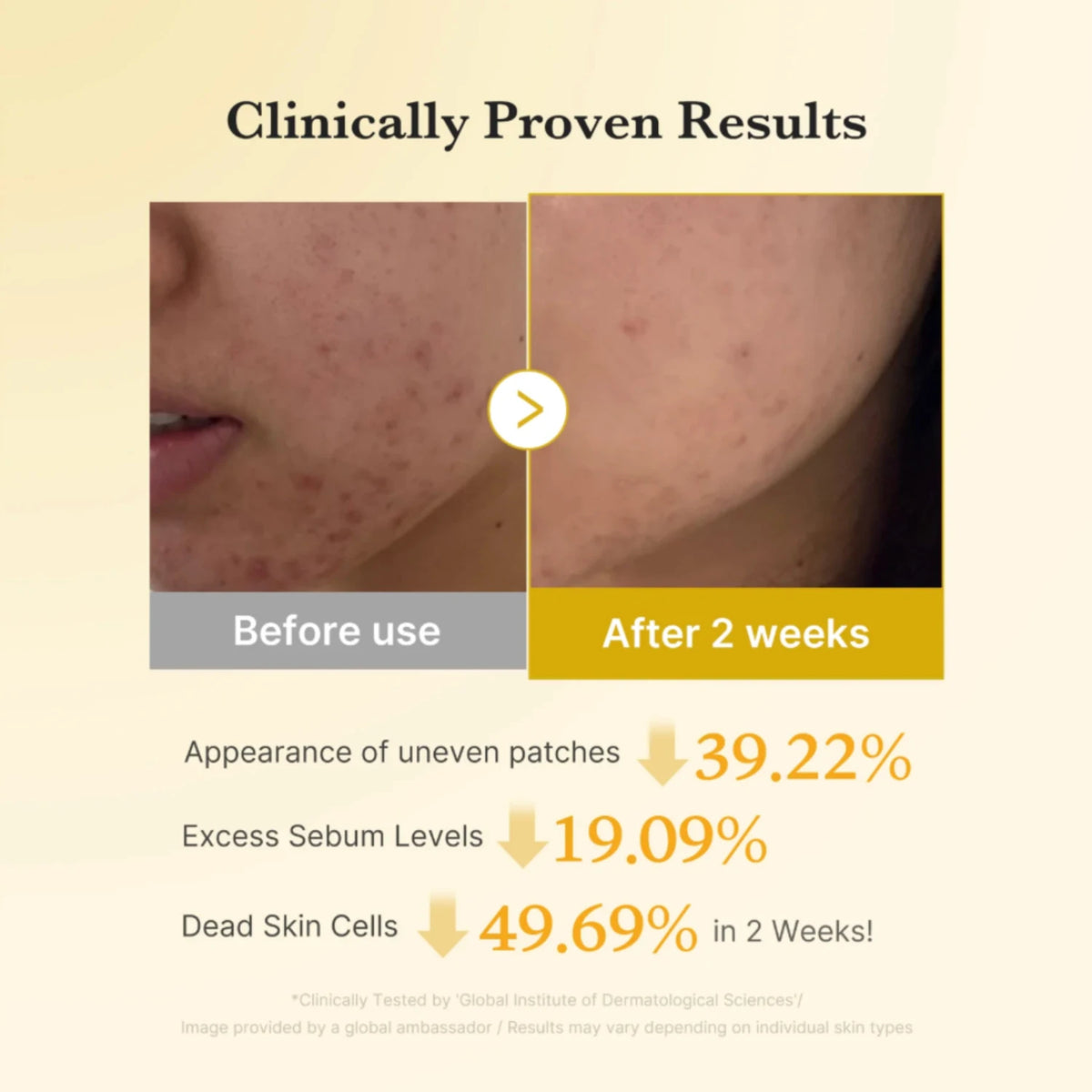 Kojic Acid Turmeric Pad
