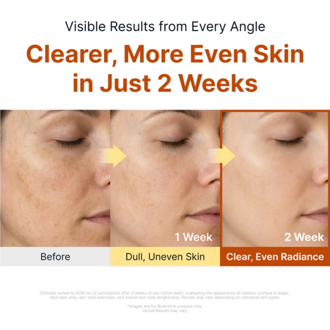 Kojic Acid Niacinamide Brightening Ampoule