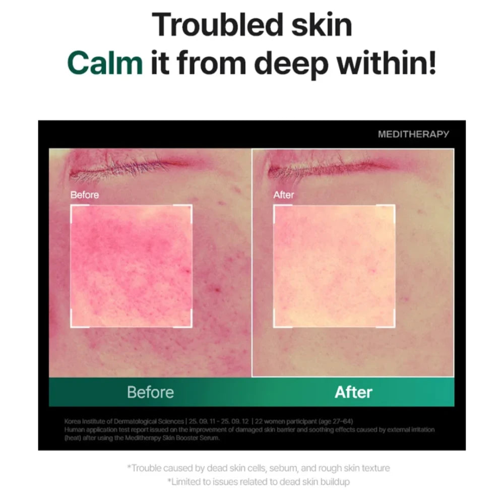 PDRN Skin Booster Serum