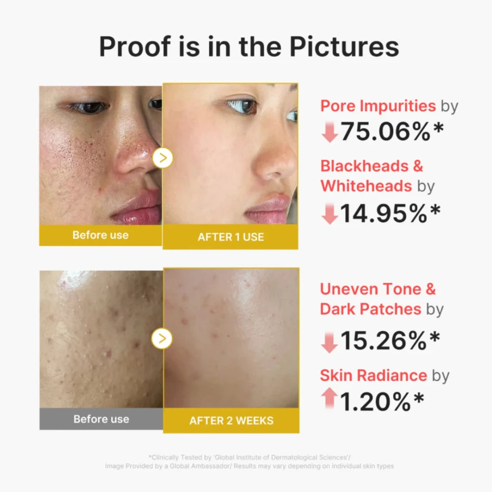 Kojic Acid Turmeric Peel Shot
