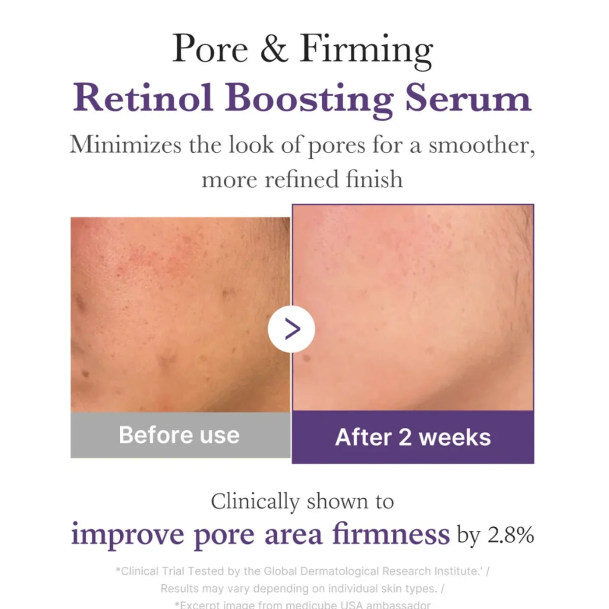 Retinol NMN Boosting Serum