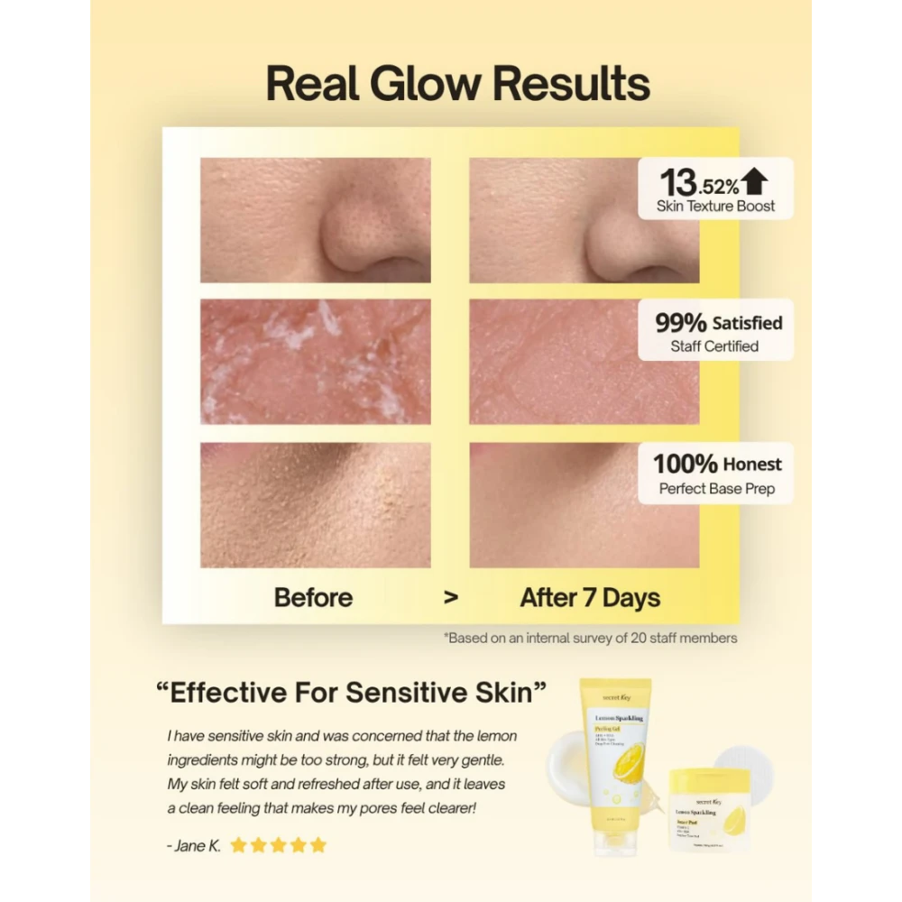 Lemon Sparkling Peeling Gel