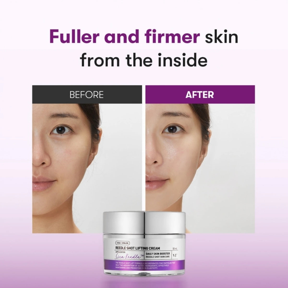 Reedle Shot Lifting Cream