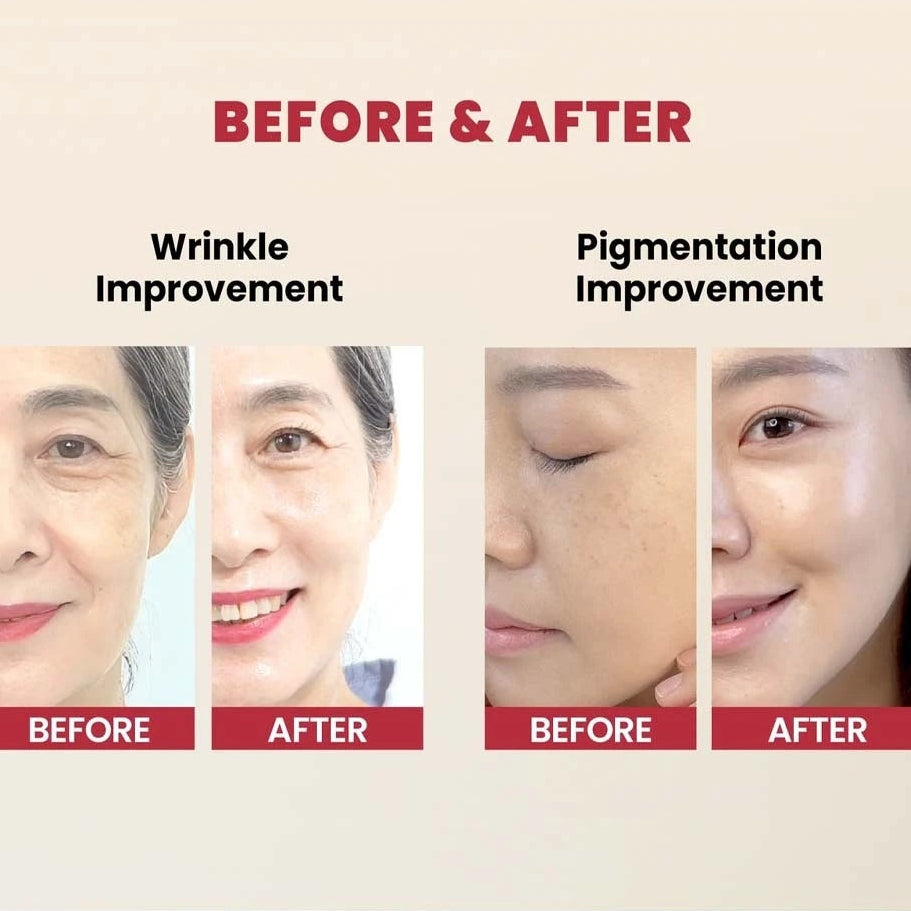 Seoul 1988 Serum Retinal Liposome 2% + Black Ginseng