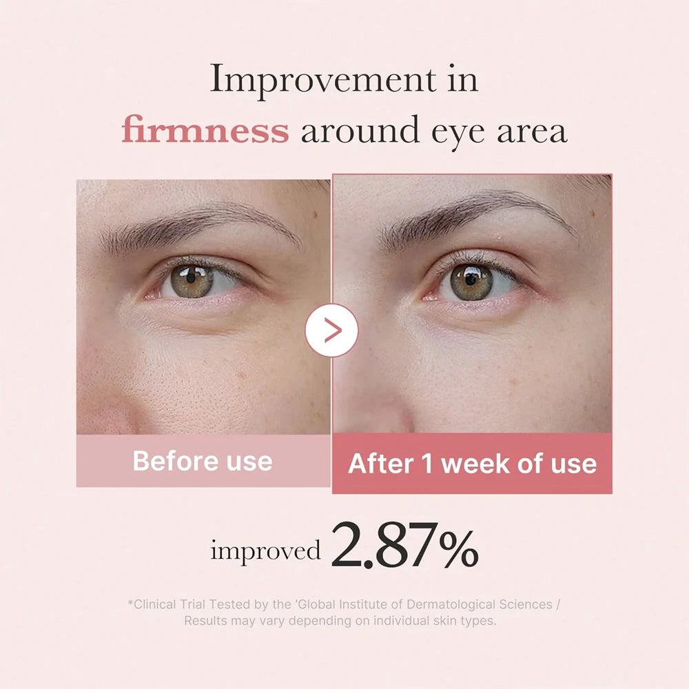 PDRN Pink Peptide Eye Cream