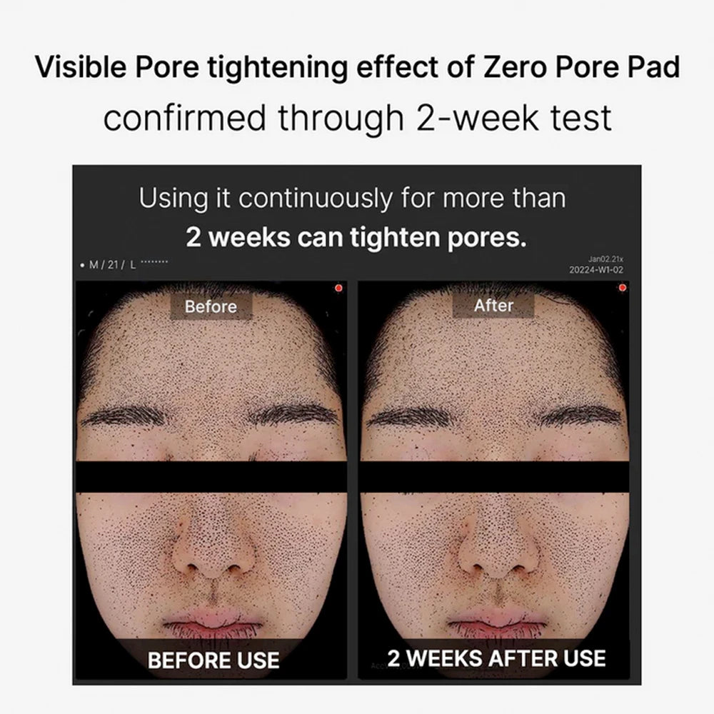 Zero Pore Pad