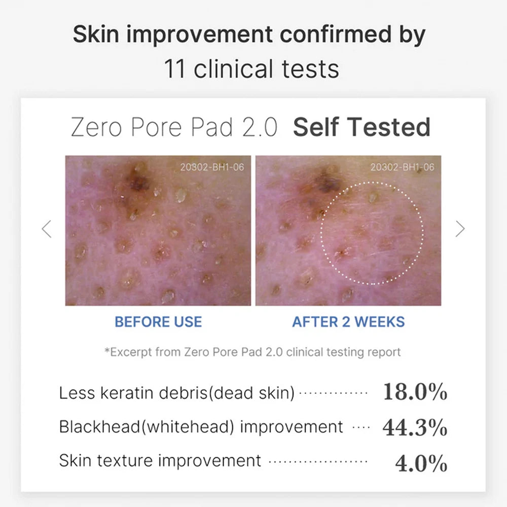 Zero Pore Pad