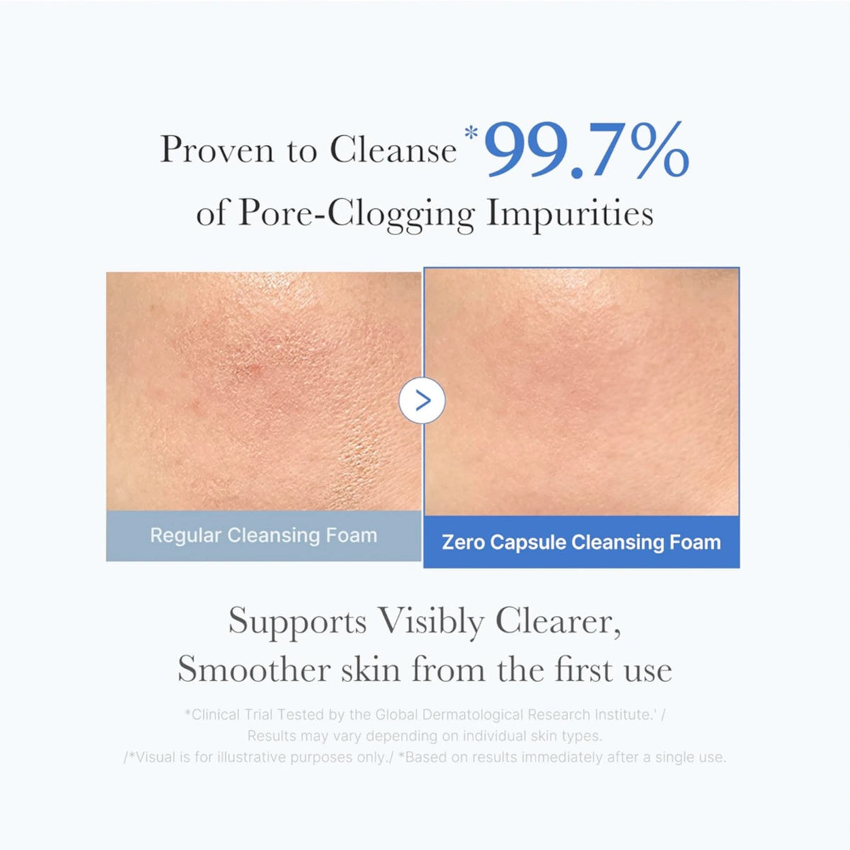 Zero Pore SA Clearing Capsule Cleansing Foam