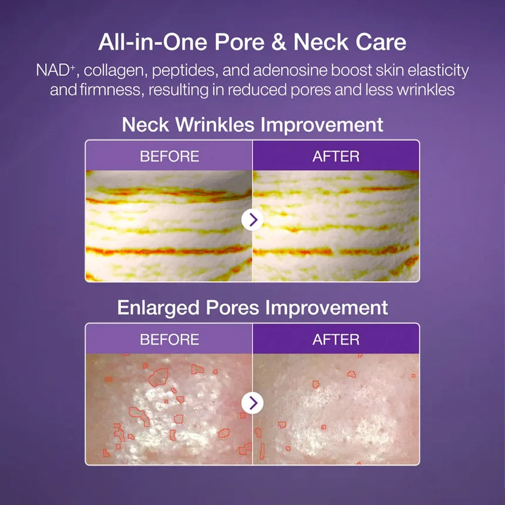 No.9 NAD Bio Lifting-sil Full Face Mask - 4 stk.