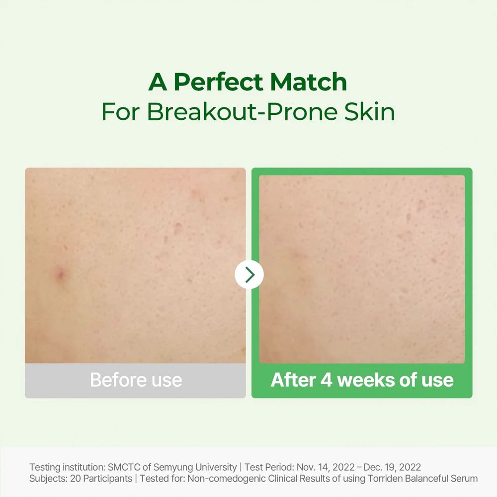 Balanceful Cica Serum